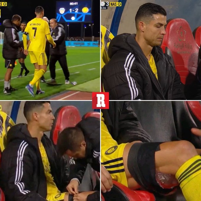 开云下载-希望问题不大！C罗在比赛中因身体不适被换下，在替补席接受冰敷
